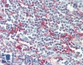 CD209 / DC-SIGN Antibody - Anti-CD209 / DC-SIGN antibody IHC of human tonsil. Immunohistochemistry of formalin-fixed, paraffin-embedded tissue after heat-induced antigen retrieval. Antibody concentration 5 ug/ml.