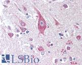 CD275 / B7-H2 / ICOS Ligand Antibody - Anti-ICOSLG / ICOSL antibody IHC of human brain, cortex. Immunohistochemistry of formalin-fixed, paraffin-embedded tissue after heat-induced antigen retrieval. Antibody dilution 1:50.