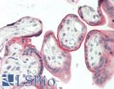 CD39 Antibody - Human Placenta: Formalin-Fixed, Paraffin-Embedded (FFPE)
