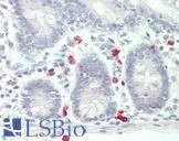 CD40L Antibody - Human Small Intestine: Formalin-Fixed, Paraffin-Embedded (FFPE)