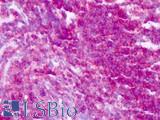 CD45 / LCA Antibody - Anti-CD45 antibody IHC of human tonsil. Immunohistochemistry of formalin-fixed, paraffin-embedded tissue after heat-induced antigen retrieval. Antibody dilution 2.5-5 ug/ml.