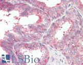 CD47 Antibody - Human Prostate: Formalin-Fixed, Paraffin-Embedded (FFPE)