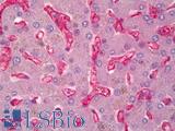 CD59 Antibody - Anti-CD59 antibody IHC of human liver. Immunohistochemistry of formalin-fixed, paraffin-embedded tissue after heat-induced antigen retrieval. Antibody dilution 1:50. This image was taken for the unconjugated form of this product. Other forms have not been tested.