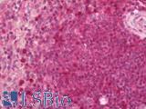CD6 Antibody - Human Spleen: Formalin-Fixed, Paraffin-Embedded (FFPE)