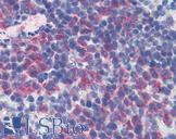 CD69 Antibody - Anti-CD69 antibody IHC of mouse spleen. Immunohistochemistry of formalin-fixed, paraffin-embedded tissue after heat-induced antigen retrieval. Antibody concentration 10 ug/ml. This image was taken for the unconjugated form of this product. Other forms have not been tested.