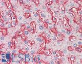 CD81 Antibody - Human Liver: Formalin-Fixed, Paraffin-Embedded (FFPE), at a dilution of 1:100. 