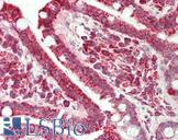 CD86 Antibody - Human Small Intestine: Formalin-Fixed, Paraffin-Embedded (FFPE)