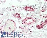 CDC6 Antibody - Human Breast, Vessels: Formalin-Fixed, Paraffin-Embedded (FFPE), at a concentration of 5 ug/ml. 