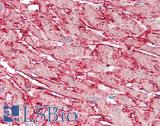CDH4 / R Cadherin Antibody - Human Heart: Formalin-Fixed, Paraffin-Embedded (FFPE), at a concentration of 10 ug/ml. 