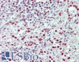 CDK15 / ALS2CR7 Antibody - Human Spleen: Formalin-Fixed, Paraffin-Embedded (FFPE)