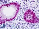 CDKN1A / WAF1 / p21 Antibody - Anti-CDKN1A / WAF1 / p21 antibody IHC staining of human uterus, endometrium. Immunohistochemistry of formalin-fixed, paraffin-embedded tissue after heat-induced antigen retrieval.