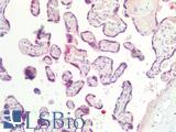 CGB / hCG Beta Antibody - Human Placenta: Formalin-Fixed, Paraffin-Embedded (FFPE)