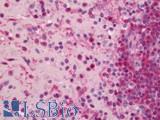 CHD1 Antibody - Human Spleen: Formalin-Fixed, Paraffin-Embedded (FFPE)