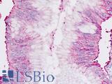Chordin Antibody - Human Pancreas: Formalin-Fixed, Paraffin-Embedded (FFPE)