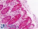 CLASP2 Antibody - Human Colon: Formalin-Fixed, Paraffin-Embedded (FFPE)