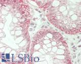 CLDN7 / Claudin 7 Antibody - Human Colon: Formalin-Fixed, Paraffin-Embedded (FFPE)