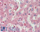 CLEC4E / MINCLE Antibody - Human Liver: Formalin-Fixed, Paraffin-Embedded (FFPE), at a dilution of 1:100.