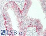 CMTM6 / CKLFSF6 Antibody - Human Uterus: Formalin-Fixed, Paraffin-Embedded (FFPE)