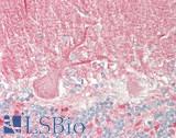 CNGA3 Antibody - Human Brain, Cerebellum: Formalin-Fixed, Paraffin-Embedded (FFPE)