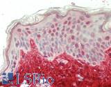 COL1A2 / Collagen I Alpha 2 Antibody - Human Skin: Formalin-Fixed, Paraffin-Embedded (FFPE)