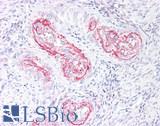COL5A2 / Collagen V Alpha 2 Antibody - Human Uterus, Myometrial Vessels: Formalin-Fixed, Paraffin-Embedded (FFPE)