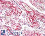 Collagen II Antibody - Human Placenta: Formalin-Fixed, Paraffin-Embedded (FFPE)