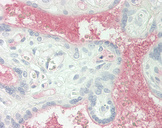 Complement C1s Antibody - Human Placenta: Formalin-Fixed, Paraffin-Embedded (FFPE)