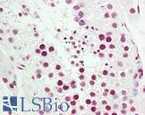 COUP-TFII / NR2F2 Antibody - Anti-COUP-TFII / NR2F2 antibody IHC staining of human testis. Immunohistochemistry of formalin-fixed, paraffin-embedded tissue after heat-induced antigen retrieval. Antibody dilution 1:50.