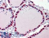 CRABP1 / CRABP Antibody - Anti-CRABP1 antibody IHC of human thyroid. Immunohistochemistry of formalin-fixed, paraffin-embedded tissue after heat-induced antigen retrieval. Antibody concentration 5 ug/ml.