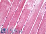 CRYAB / Alpha B Crystallin Antibody - Anti-CRYAB / Alpha B Crystallin antibody IHC staining of human skeletal muscle. Immunohistochemistry of formalin-fixed, paraffin-embedded tissue after heat-induced antigen retrieval. Antibody dilution 1:100.