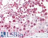 CSE1L Antibody - Anti-CSE1L antibody IHC of human testis. Immunohistochemistry of formalin-fixed, paraffin-embedded tissue after heat-induced antigen retrieval. Antibody dilution 1:100.