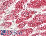 CTSA / Cathepsin A Antibody - Human Adrenal: Formalin-Fixed, Paraffin-Embedded (FFPE)
