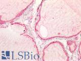 CTSB / Cathepsin B Antibody - Human Thyroid: Formalin-Fixed, Paraffin-Embedded (FFPE)