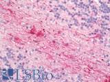CYBB / NOX2 / gp91phox Antibody - Human Brain, Cerebellum: Formalin-Fixed, Paraffin-Embedded (FFPE)