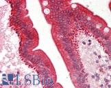 CYP3A5 Antibody - Human Small Intestine: Formalin-Fixed, Paraffin-Embedded (FFPE).  This image was taken for the unconjugated form of this product. Other forms have not been tested.