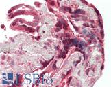 DAPK1 / DAP Kinase Antibody - Human Placenta: Formalin-Fixed, Paraffin-Embedded (FFPE)