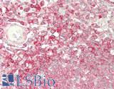 DIAPH1 Antibody - Human Spleen: Formalin-Fixed, Paraffin-Embedded (FFPE)
