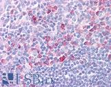 DLL1 Antibody - Anti-DLL1 antibody IHC of human tonsil. Immunohistochemistry of formalin-fixed, paraffin-embedded tissue after heat-induced antigen retrieval. Antibody concentration 5 ug/ml.  This image was taken for the unconjugated form of this product. Other forms have not been tested.
