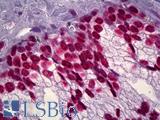 DNA ds Antibody - Anti-DNA ds antibody IHC of human prostate. Immunohistochemistry of formalin-fixed, paraffin-embedded tissue after heat-induced antigen retrieval. Antibody dilution 1:50.