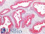DPP4 / CD26 Antibody - Human Prostate: Formalin-Fixed, Paraffin-Embedded (FFPE)