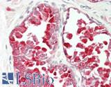 DSG4 / Desmoglein 4 Antibody - Human Prostate: Formalin-Fixed, Paraffin-Embedded (FFPE)