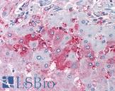 DUSP26 / MKP8 Antibody - Anti-DUSP26 antibody IHC of human liver. Immunohistochemistry of formalin-fixed, paraffin-embedded tissue after heat-induced antigen retrieval.