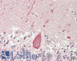 DUX4 Antibody - Human Brain, Cerebellum: Formalin-Fixed, Paraffin-Embedded (FFPE)
