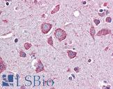 EIF2B2 Antibody - Anti-EIF2B2 / EIF2B antibody IHC of human brain, cortex. Immunohistochemistry of formalin-fixed, paraffin-embedded tissue after heat-induced antigen retrieval. Antibody concentration 5 ug/ml.