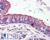 ELOVL6 Antibody - Anti-ELOVL6 antibody IHC of human lung. Immunohistochemistry of formalin-fixed, paraffin-embedded tissue after heat-induced antigen retrieval. Antibody concentration 5 ug/ml.