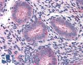 ELP3 Antibody - Anti-ELP3 antibody IHC of human uterus. Immunohistochemistry of formalin-fixed, paraffin-embedded tissue after heat-induced antigen retrieval. Antibody concentration 10 ug/ml.