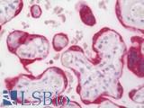 EMA / MUC1 Antibody - Human Placenta: Formalin-Fixed, Paraffin-Embedded (FFPE)