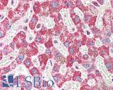 EMI2 / FBXO43 Antibody - Anti-FBXO43 / EMI2 antibody IHC of human liver. Immunohistochemistry of formalin-fixed, paraffin-embedded tissue after heat-induced antigen retrieval. Antibody concentration 5 ug/ml.