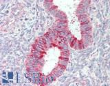ENOX1 / CNOX Antibody - Human Uterus: Formalin-Fixed, Paraffin-Embedded (FFPE), at a concentration of 10 ug/ml.