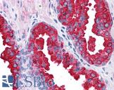 ERG Antibody - Anti-ERG antibody IHC of human prostate. Immunohistochemistry of formalin-fixed, paraffin-embedded tissue after heat-induced antigen retrieval. Antibody concentration 10 ug/ml.